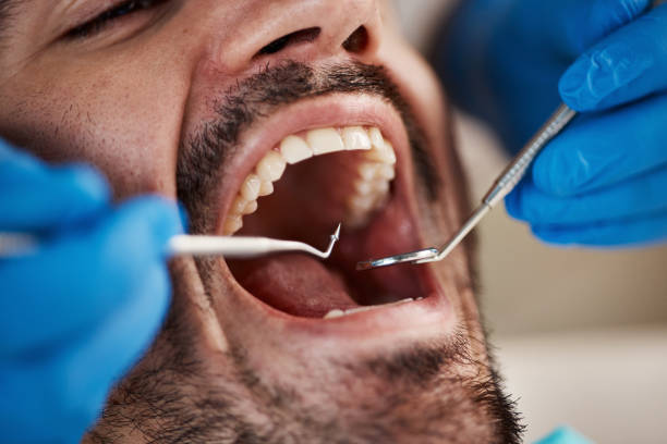 Best Root Canal Emergency Dentist  in Roosevelt, NJ