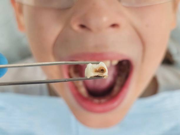 Best Urgent Tooth Repair  in Roosevelt, NJ